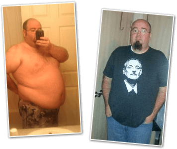 James T. Before and After Pictures